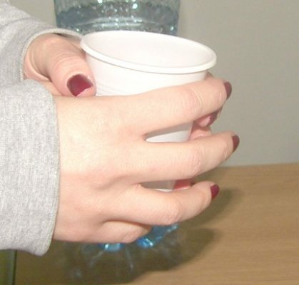 Dezechilibrele alimentare şi deshidratarea - printre cauze ale apariţiei litiazei urinare